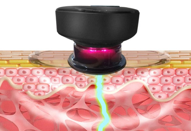 🚨MASAJEADOR INTELIGENTE💡CON VENTOSA TERAPEUTICA🤩