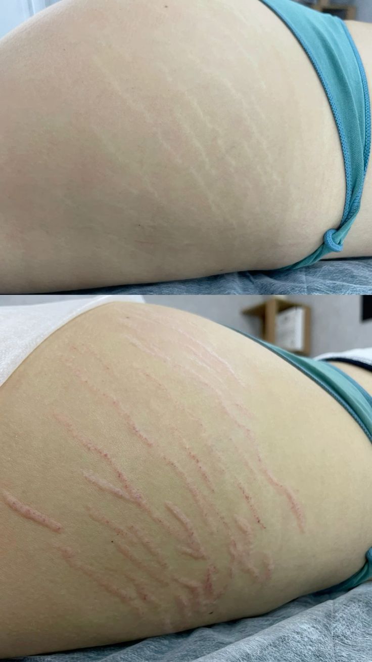 ❤️‍🔥🔥LA CREMA MULTIBENEFICIOS MÁS VIRAL🚨❤️‍🔥