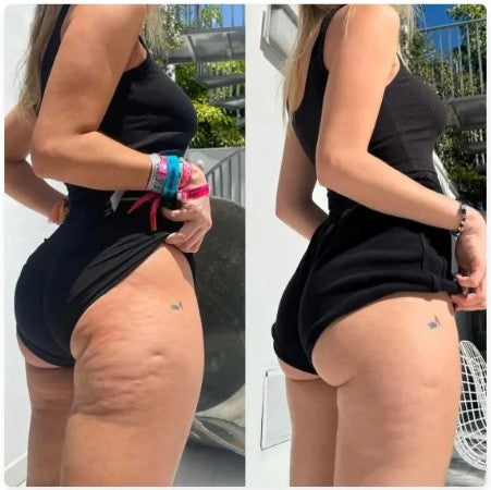 🚨MASAJEADOR INTELIGENTE💡CON VENTOSA TERAPEUTICA🤩