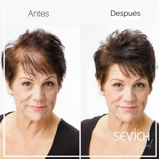 🥳ADIÓS A LOS PARCHES DE TU CABEZA O BARBA😎FIBRA CAPILAR✅