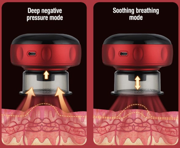 🚨MASAJEADOR INTELIGENTE💡CON VENTOSA TERAPEUTICA🤩